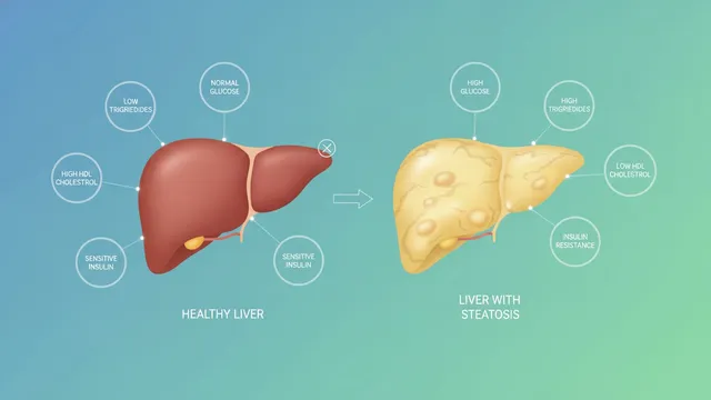 Side-by-side illustration comparing a healthy liver and a fatty liver with steatosis, surrounded by labeled metabolic markers